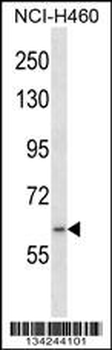 RNF19A Antibody (Center)