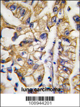HDBP1 Antibody (Center)
