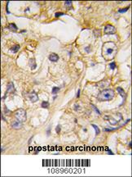 DRAGON (RGMB) Antibody (Center)