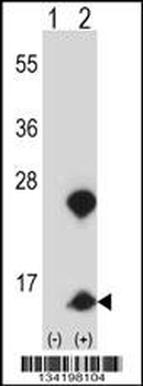 HMGN1 Antibody (N-term)