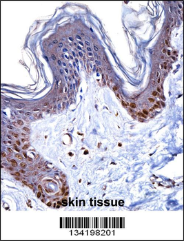 HMGN1 Antibody (N-term)