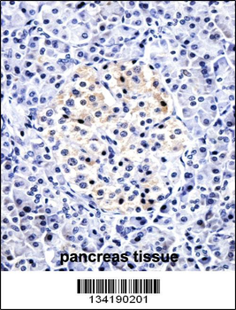 CCL15 Antibody (C-term)