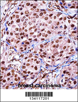ZBTB7A Antibody (C-term)