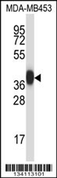 PRSS8 Antibody (Center)