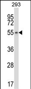 KIAA0895 Antibody (N-term)