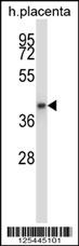 GNAQ Antibody (N-term)