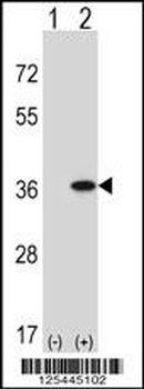 GNAQ Antibody (N-term)