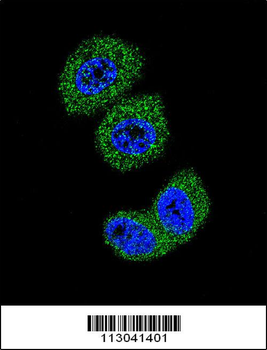 FOXO3 Antibody (Center)
