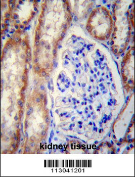 FOXO3 Antibody (Center)