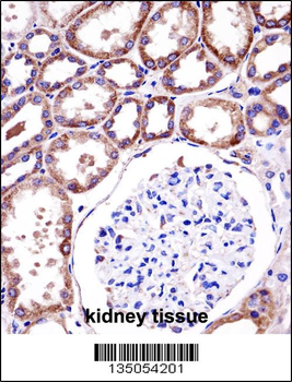 RC3H1 Antibody (C-term)