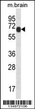 Mouse Pxk Antibody (Center)