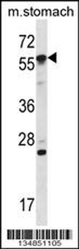Mouse Oxsr1 Antibody (N-term)