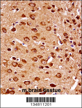 Mouse Map2k7 Antibody (Center)