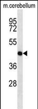 Mouse Map2k1 Antibody (C-term)