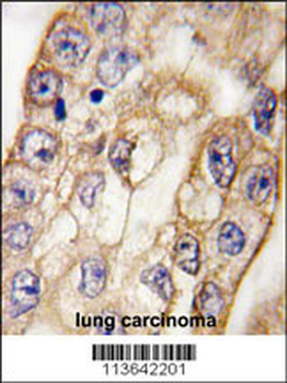 CD8A Antibody (C-term)