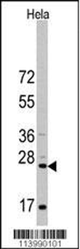 CD8A Antibody (N-term)