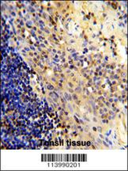 CD8A Antibody (N-term)