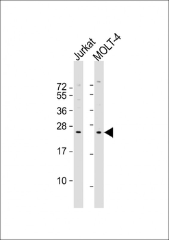 CD8A Antibody (N-term)