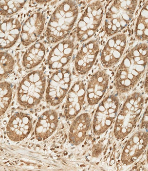 CDKN2B Antibody (C-term)
