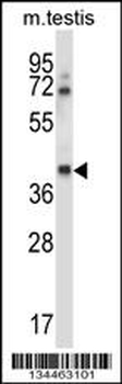 Mouse Csnk1g1 Antibody (C-term)