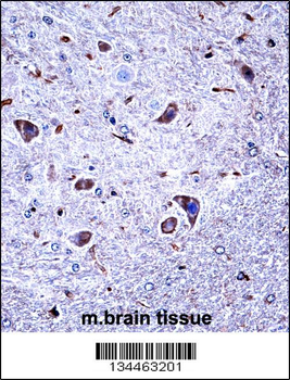 Mouse Csnk1g1 Antibody (C-term)