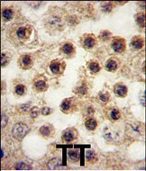 YBX2 Antibody (C-term)