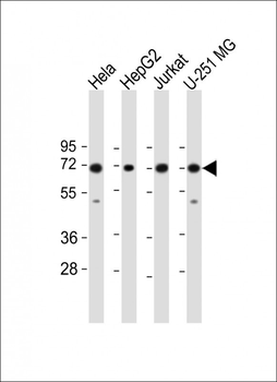 FUBP1 Antibody (Center)