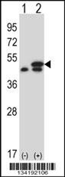 EEF1G Antibody (Center)