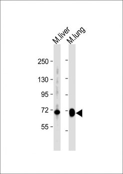 Mouse Hipk4 Antibody (C-term)