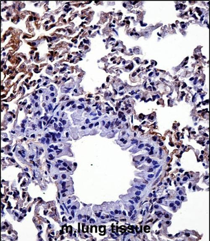 Mouse Hipk4 Antibody (C-term)