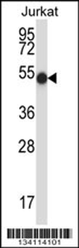 PNKP Antibody (N-term)