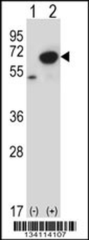 PNKP Antibody (N-term)