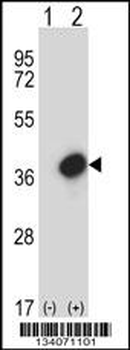 GTF2E2 Antibody (C-term)