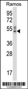 NCK2 Antibody (N-term)