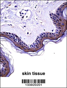 NCK2 Antibody (N-term)
