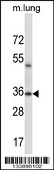 ERCC1 Antibody (C-term)