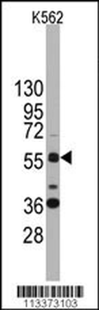 SOX9 Antibody (N-term)