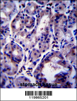 SNX24 Antibody (Center)