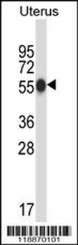 CPO Antibody (N-term)