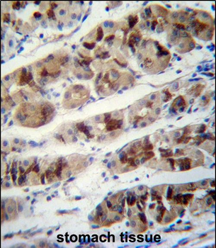PCIA1 Antibody (Center)