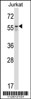 BECN1 Antibody (N-term T72)