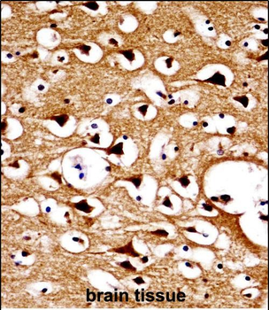 NUMBL Antibody (C-term)