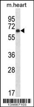Mouse Pkmyt1 Antibody (N-term)