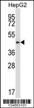 Mouse Pdk2 Antibody (N-term)