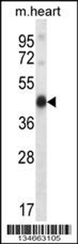 Mouse Pdk2 Antibody (N-term)