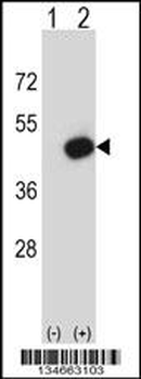 Mouse Pdk2 Antibody (N-term)