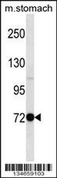 Mouse Pak7 Antibody (N-term)