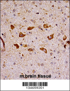 Mouse Pak7 Antibody (N-term)