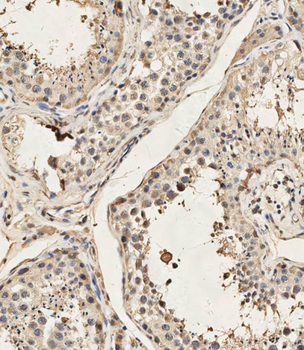 Mouse Dyrk2 Antibody (C-term)