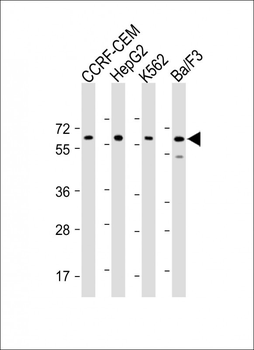 Mouse Dyrk2 Antibody (C-term)